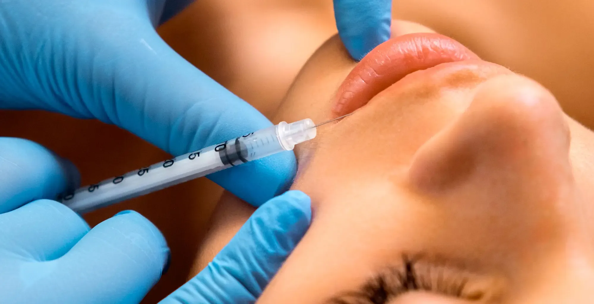 Injection d'acide hyaluronique aux Sables d’Olonne