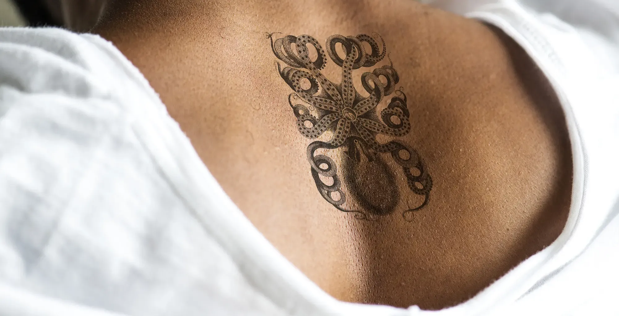 Laser PicoPlus™ Sables d'Olonne